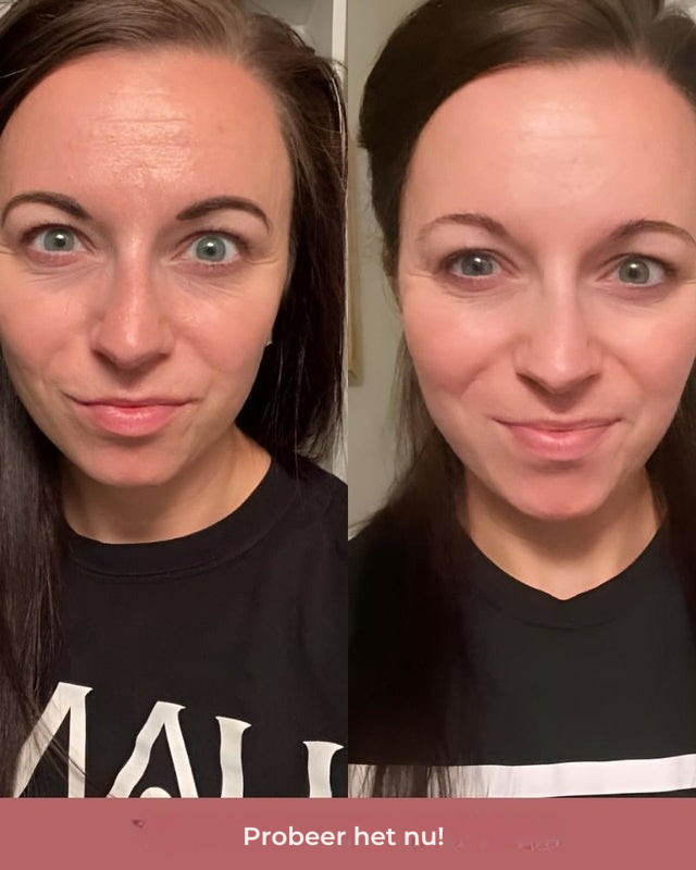 Yloura™ | Bio-Collagen Mask
