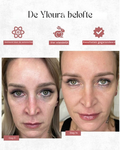 Yloura™ | Bio-Collagen Mask
